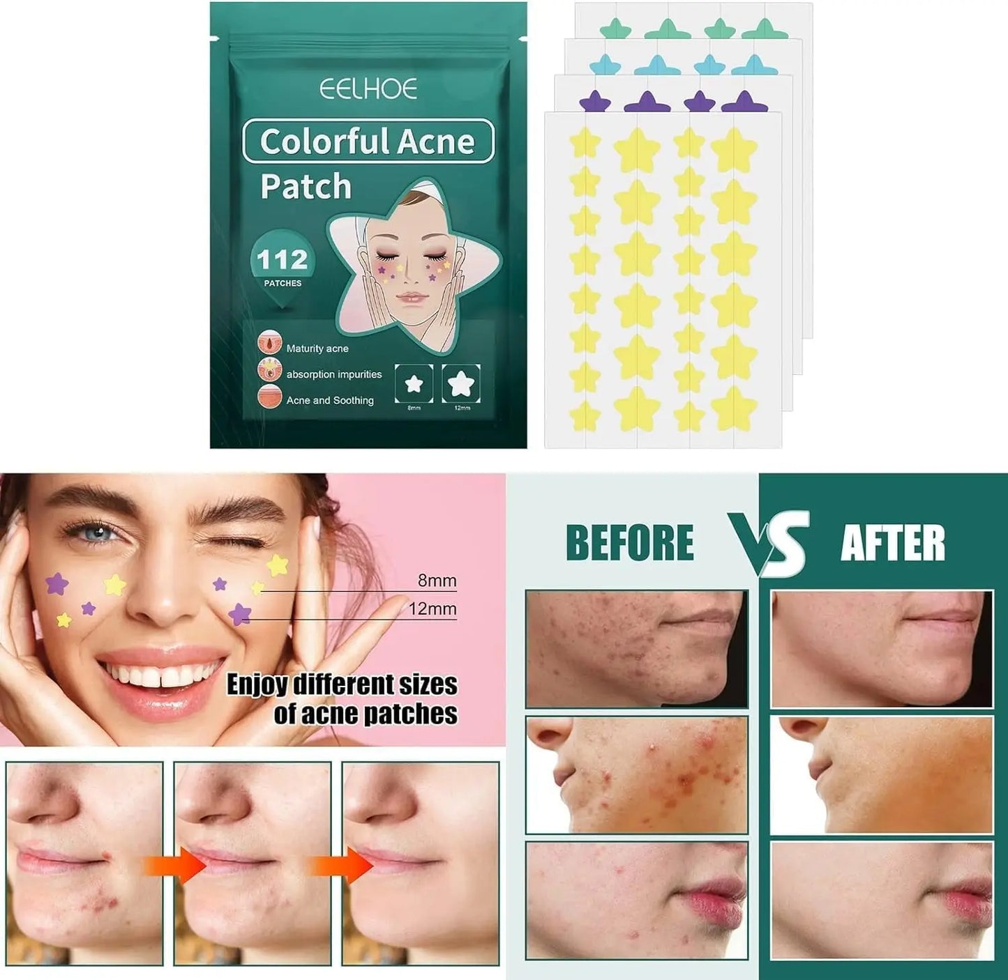 112Pcs Invisible Removal Pimple Patches Star Tools Pimple Concealer Face Scars Care Stickers Pimple Patches Treatments Blemish Patches Zit Patches,Tools and Accessories