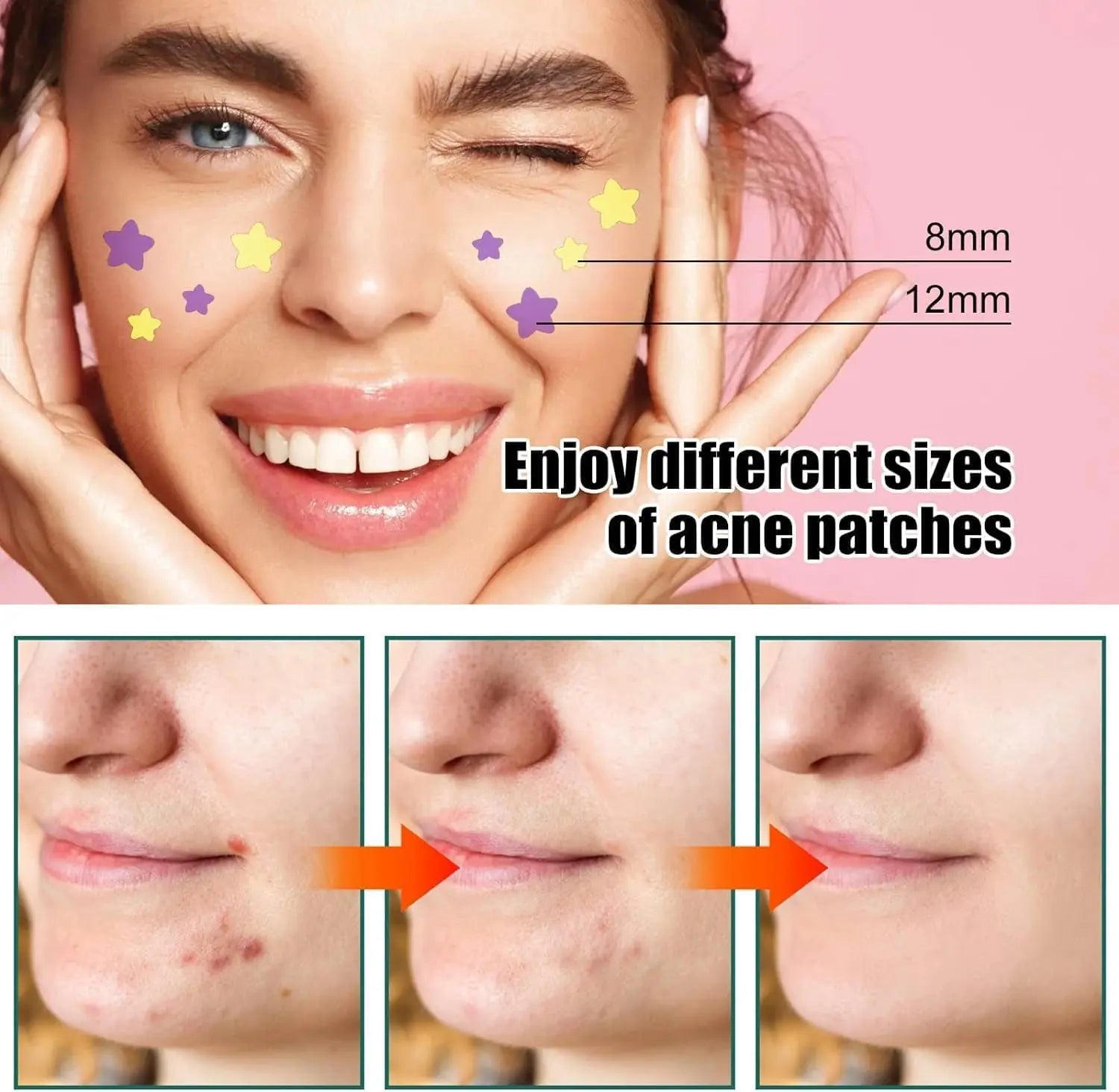 112Pcs Invisible Removal Pimple Patches Star Tools Pimple Concealer Face Scars Care Stickers Pimple Patches Treatments Blemish Patches Zit Patches,Tools and Accessories